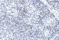 GREMLIN Antibody (C-term)